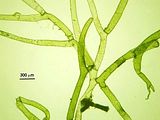 Dettaglio degli articoli nella porzione mediana del tallo